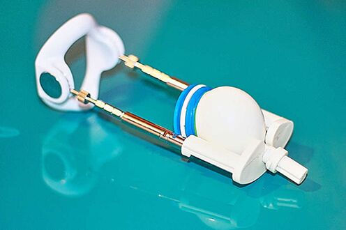 Extender - Ein Gerät für eine effektive Erhöhung eines Mitglieds